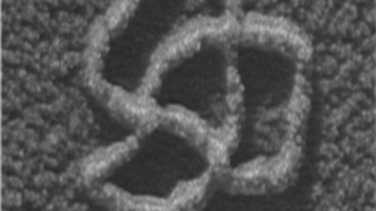DNA knot as seen under the electron microscope. 