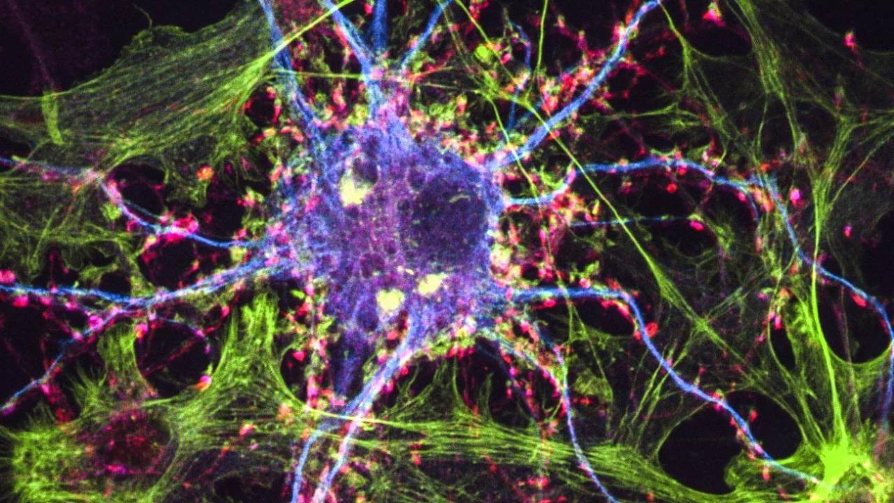 Image of nerve cells in the brain